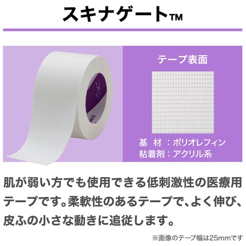 スキナゲートスモールパックSG25H_画像03