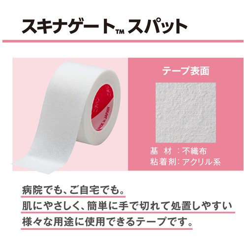 スキナゲートスパットSGS25_画像03