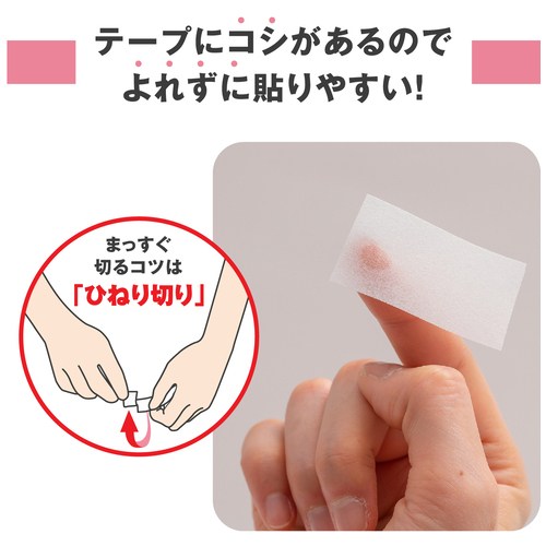 スキナゲートスパットSGS25_画像04